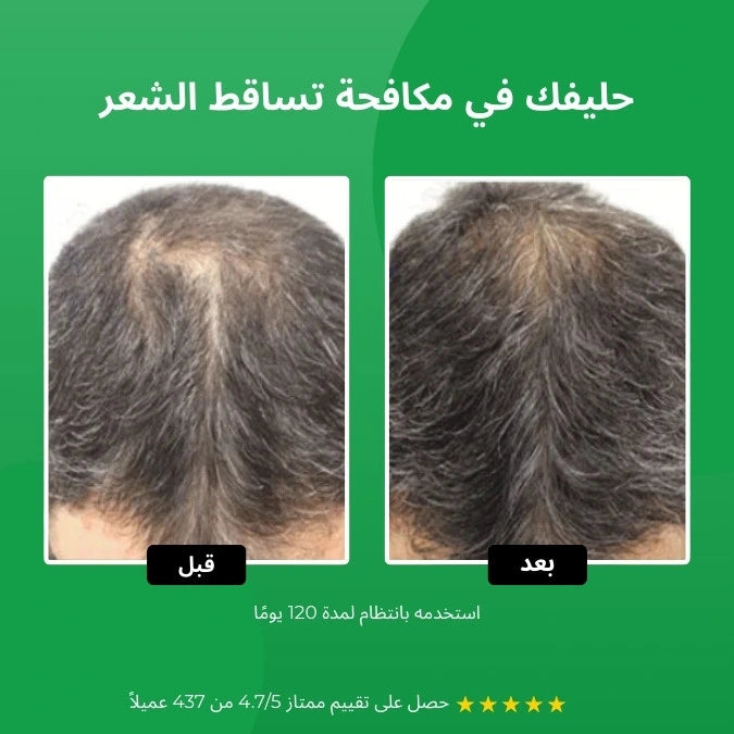 حقيبة مضادة للسقوط للرجال